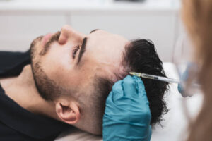 PRP hair treatment in Dubai