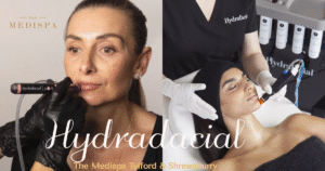 hydrafacial treatment medispa