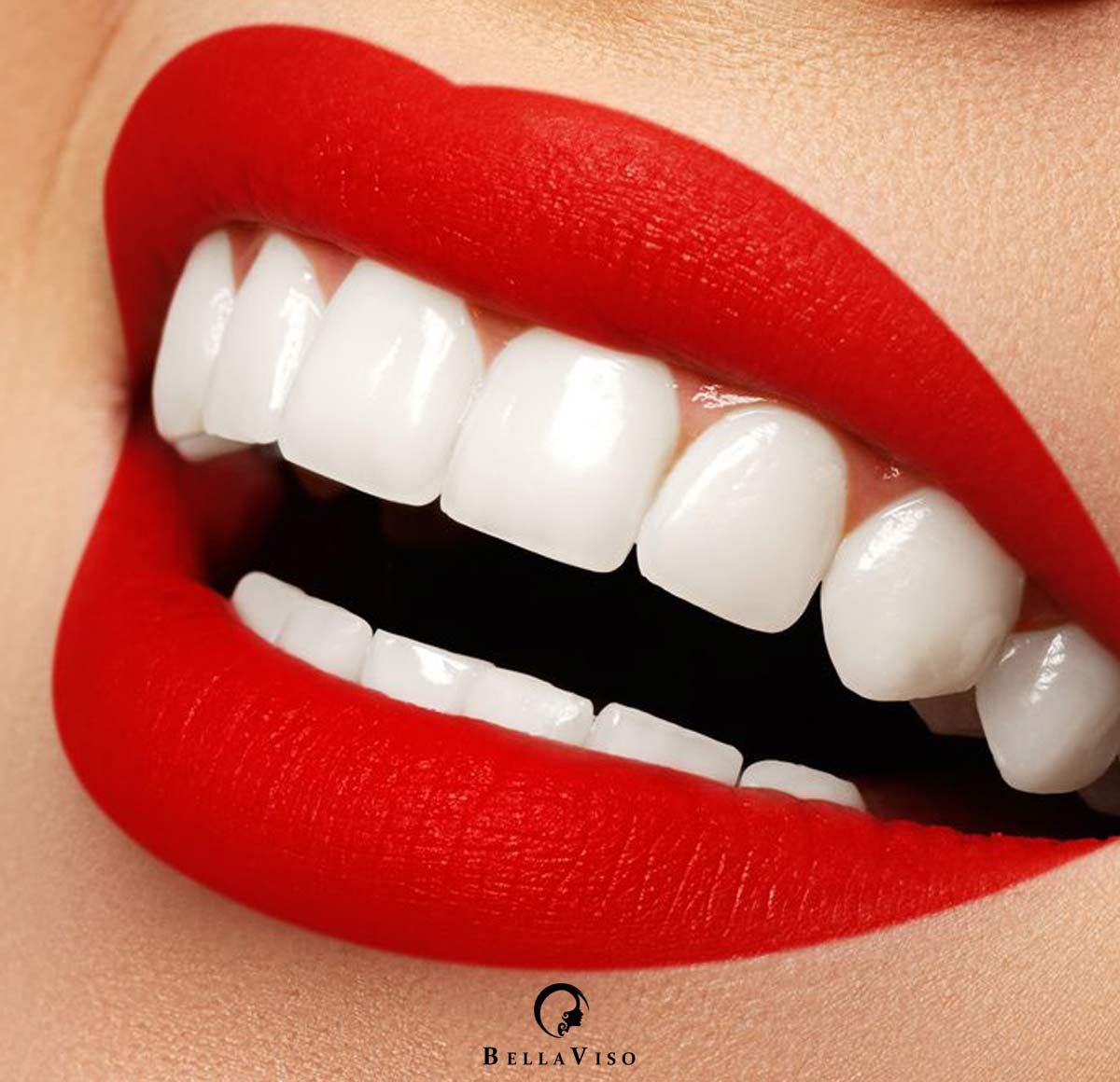 Dubai’s Dazzling Smiles: Unveiling the Best Medical Centers for Dental Veneers in Dubai