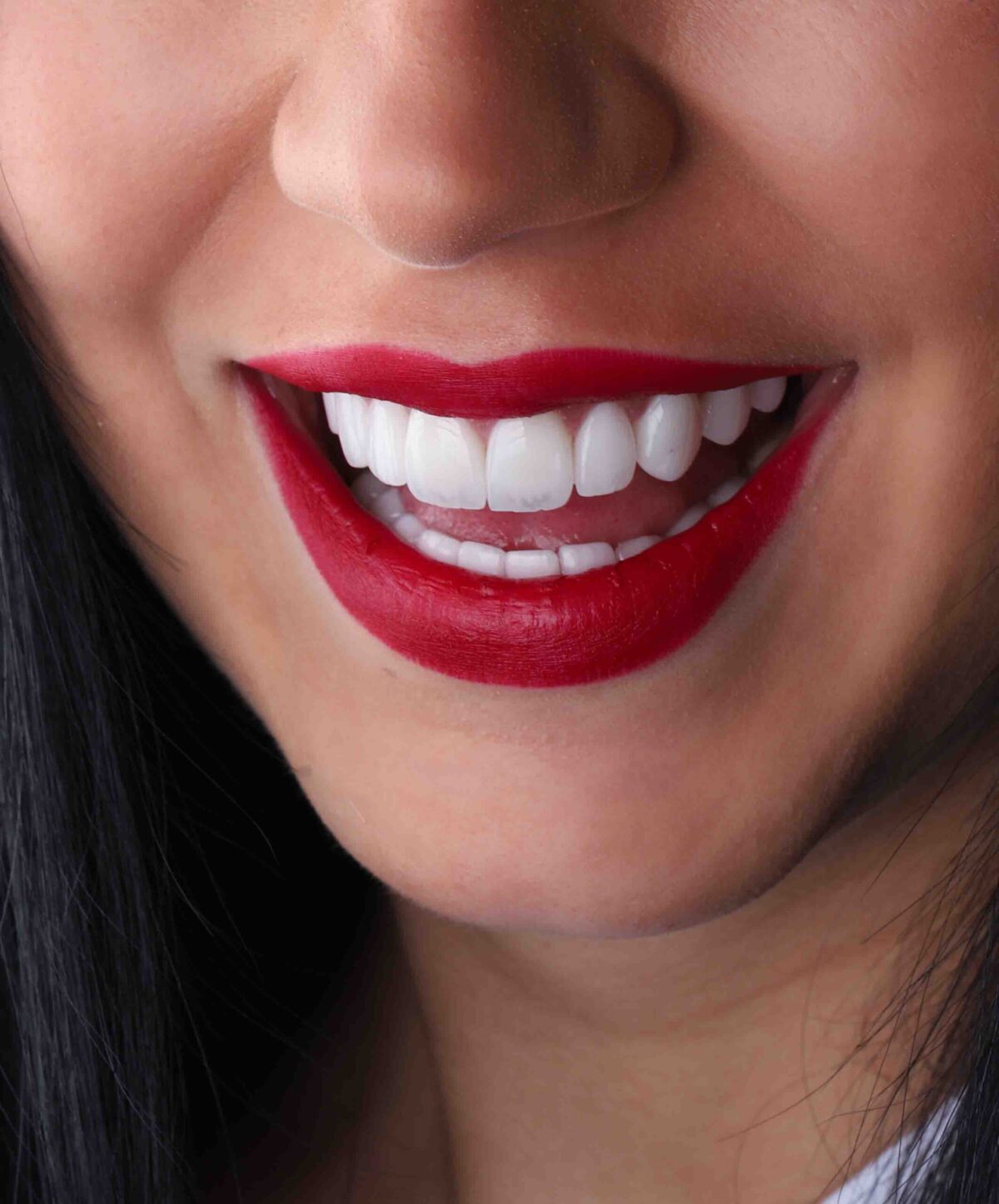 Finding Affordable Smiles in Dubai: Exploring Option Cheap Dental Clinic in Dubai