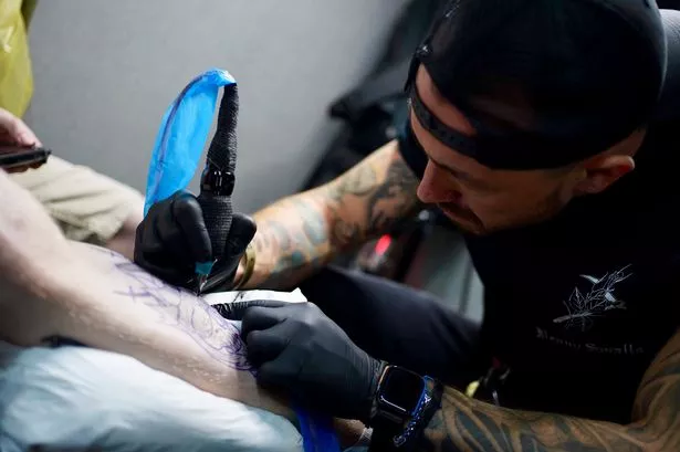 How to Prepare for Your Laser Tattoo Removal Appointment?