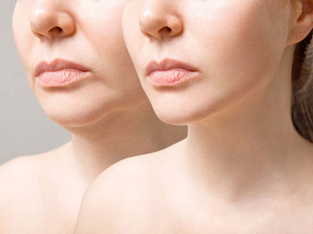 What to Consider When Planning Facial Plastic Surgery in Hawaii?