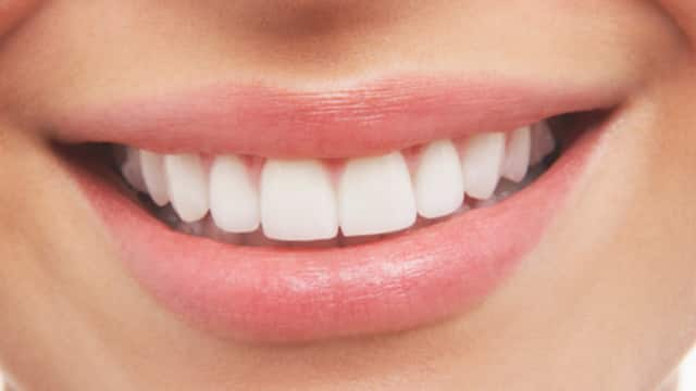 What are the Benefits of Teeth Whitening Before and After in Dubai?