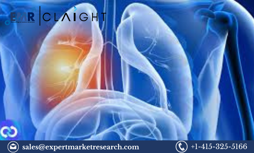 Non-Small Cell Lung Cancer Treatment Market: Comprehensive Analysis and Future Outlook 2032