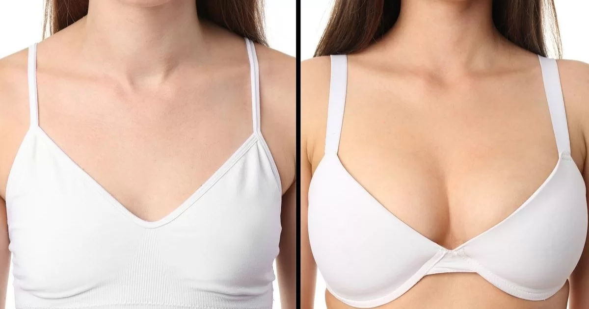 Before and After: Stunning Transformations from Breast Augmentation in Dubai