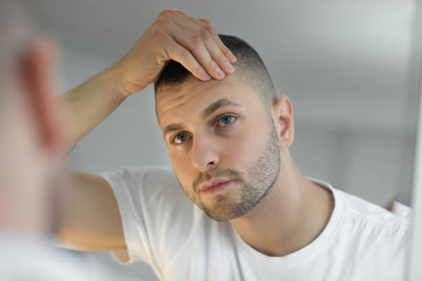 Effective Hair Loss Treatments: A Comprehensive Guide