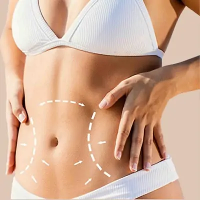 Patient Safety What the Best Full Body Liposuction Surgeons in Dubai Want You to Know