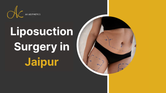 Liposuction Surgery Cost in Jaipur - Dr Akangsha Sharma