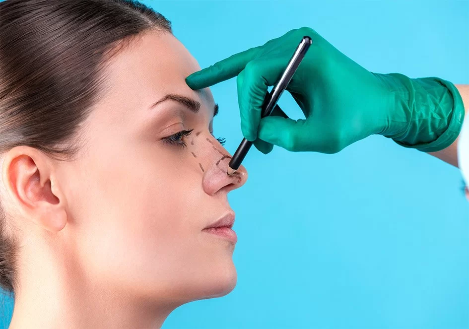 Rhinoplasty Experts (تجميل الأنف في دبي)