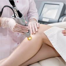 Everything You Need to Know About Laser Hair Removal in Riyadh