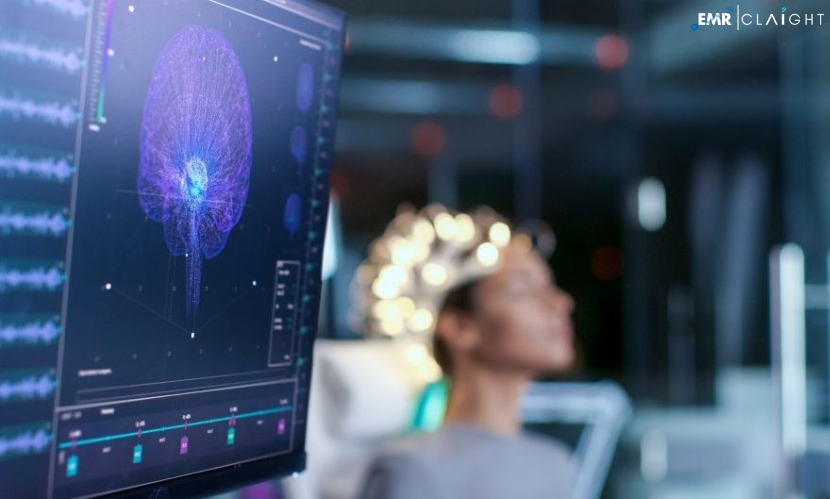 Global Neurodiagnostic and Monitoring Devices Market Trends, Insights, Size, Key Players, Trends & Forecast | 2024 – 2032