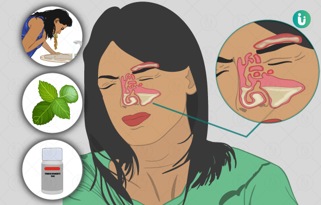 Sinusitis Drug Pipeline Analysis Report 2024