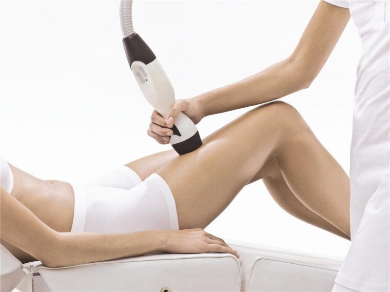 CoolSculpting in Dubai