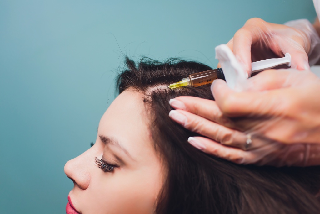 Prp Hair Treatment in Dubai