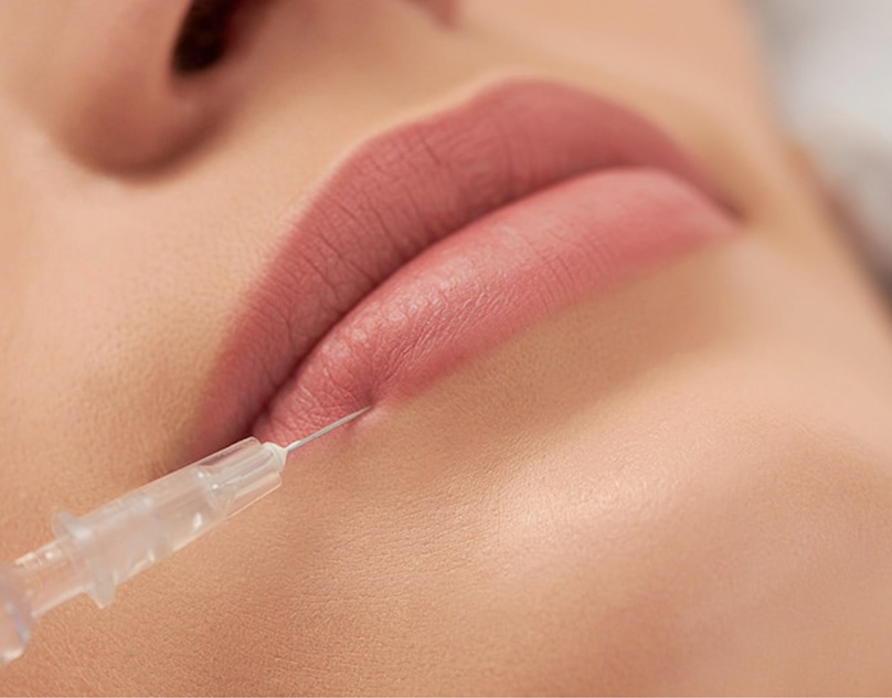 What to Do if You’re Unhappy with Your Lip Fillers