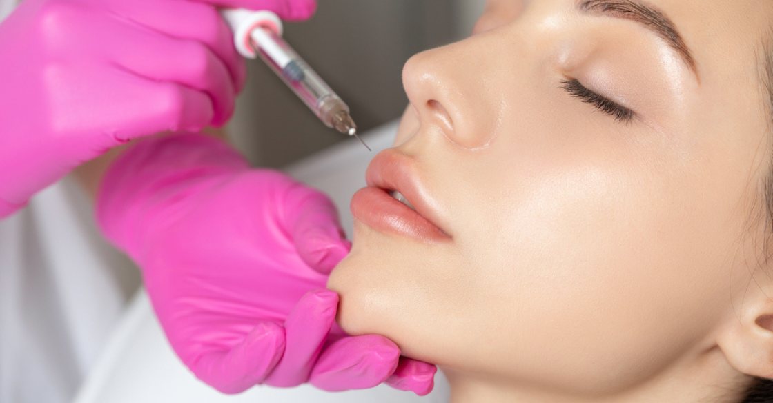 How to Avoid Lip Filler Overuse