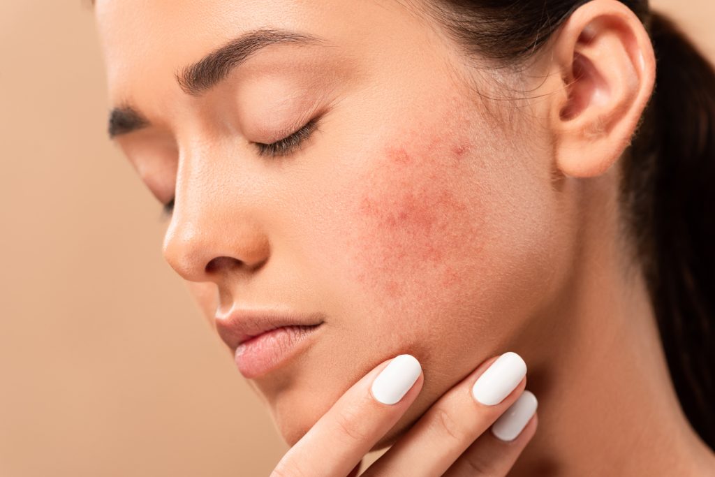 Best Dermatologist in Dubai