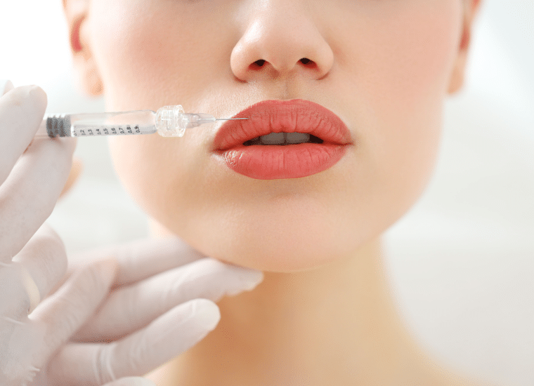 Best Lip Fillers Injections in Dubai