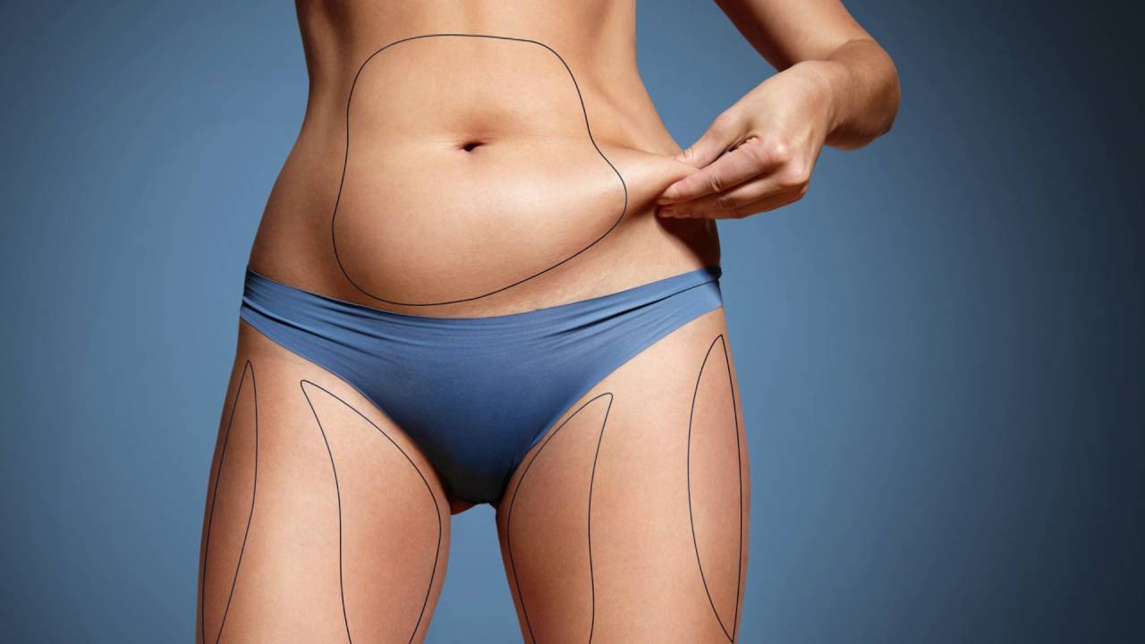Sculpt Your Body With Dubai Liposuction