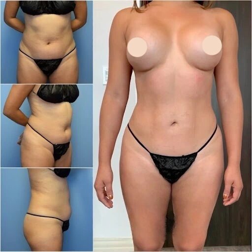 Why the Best Body Contouring Surgeons in dubai Are the Top Choice for Patients