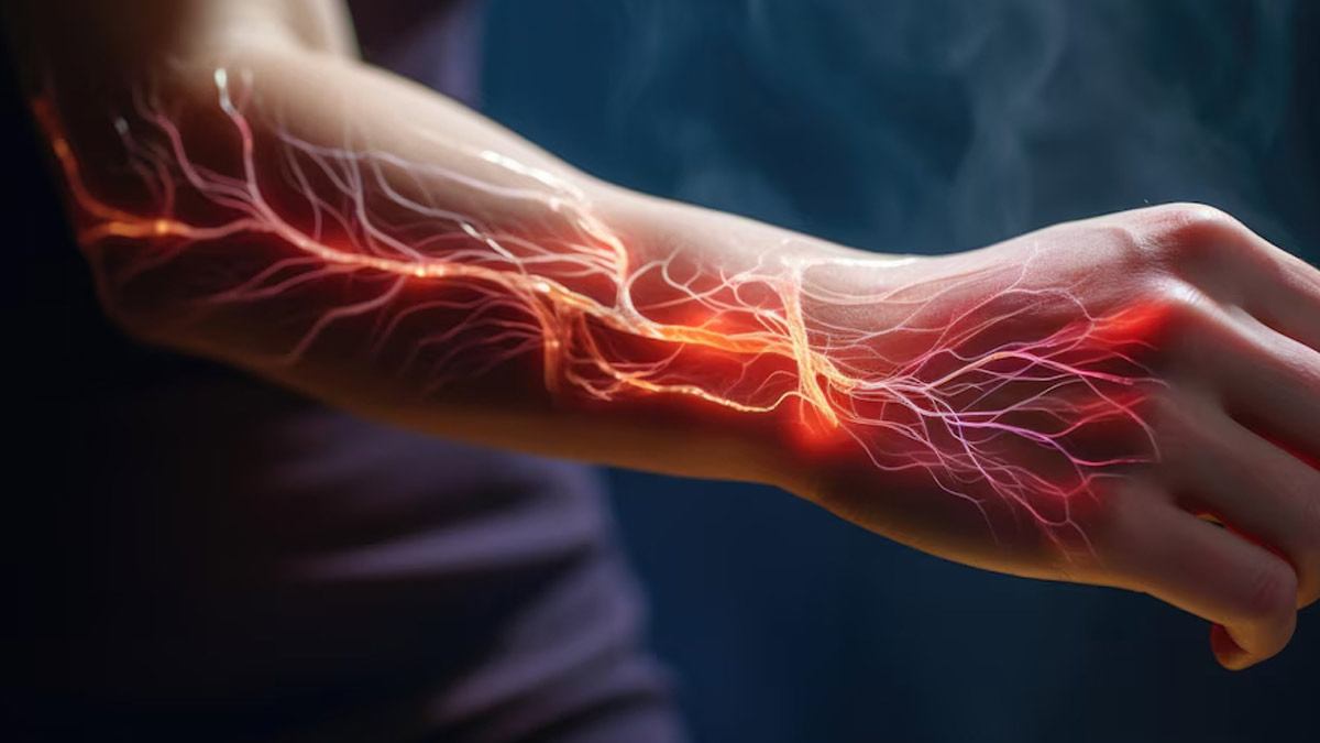 Peripheral Neuropathy: What It Is, Symptoms & Treatment