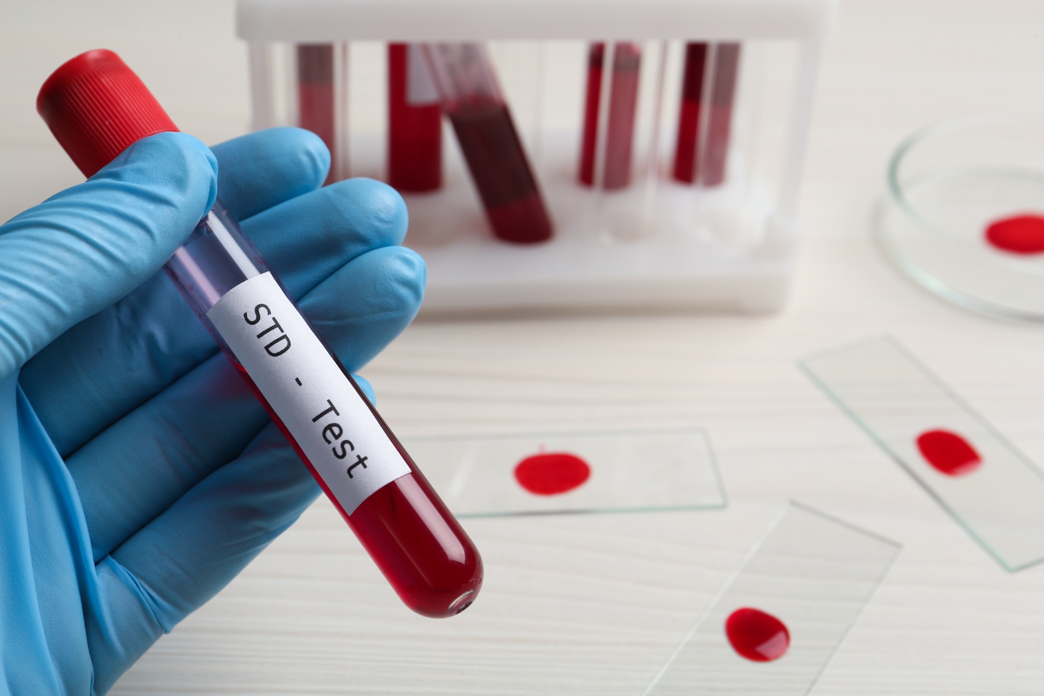 STD Test in Dubai
