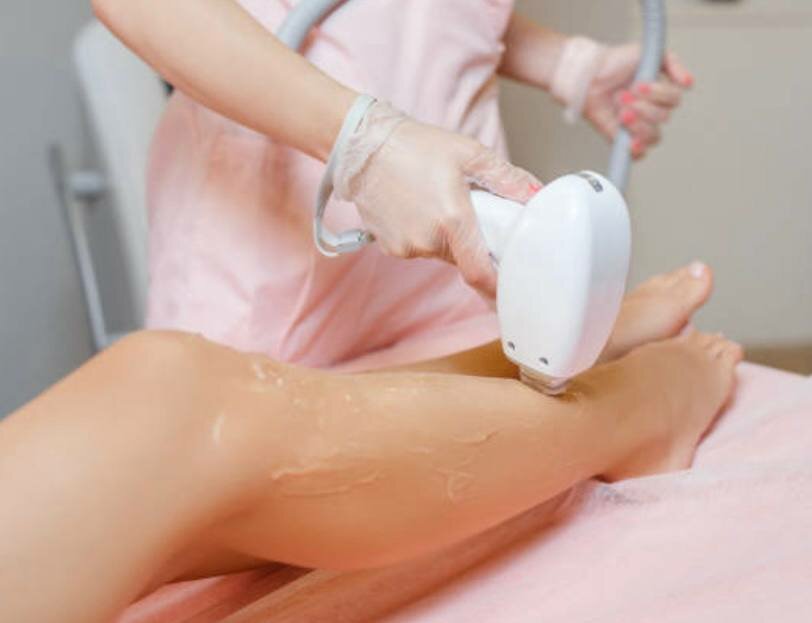 Best Laser Hair Removal in Dubai
