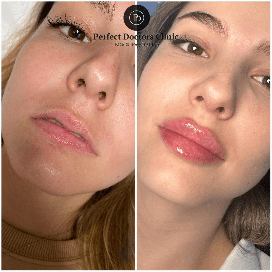 How to Select the Best Juvederm Package at the Best Aesthetic Clinics in Dubai