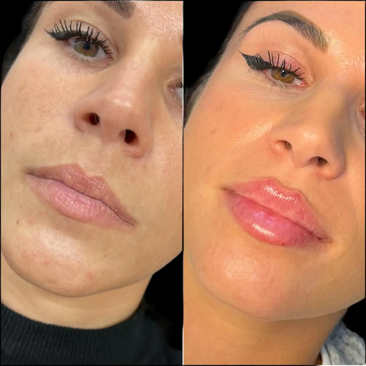 Best Aesthetic Clinics in dubai