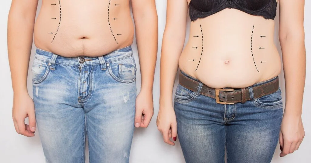 How to Choose the Right Obesity Treatment in Dubai: A Comprehensive Guide