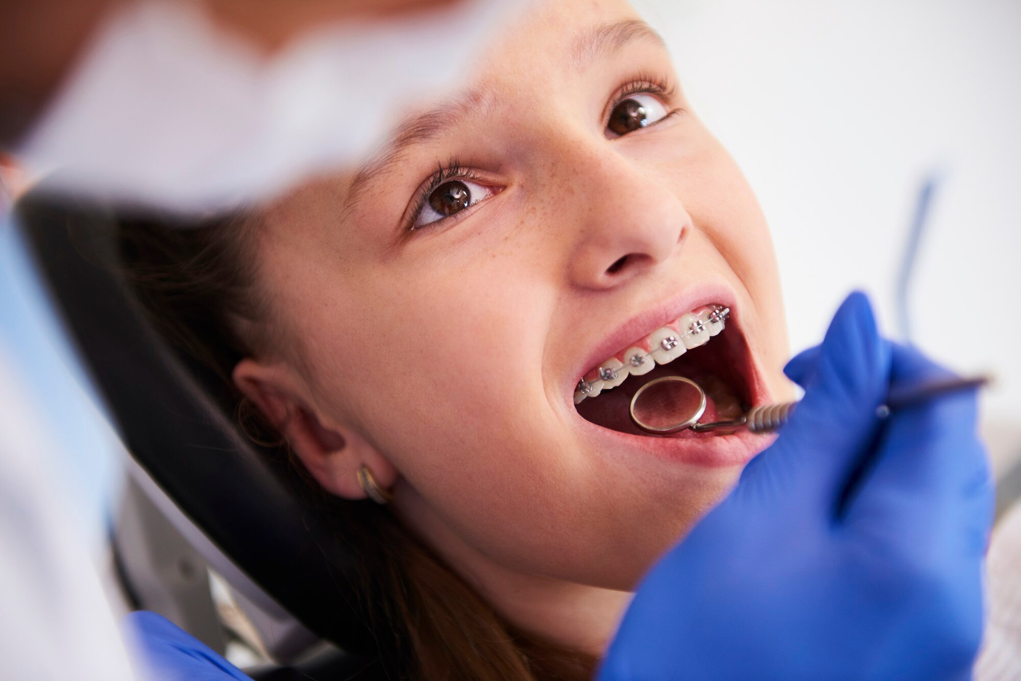 braces for kids