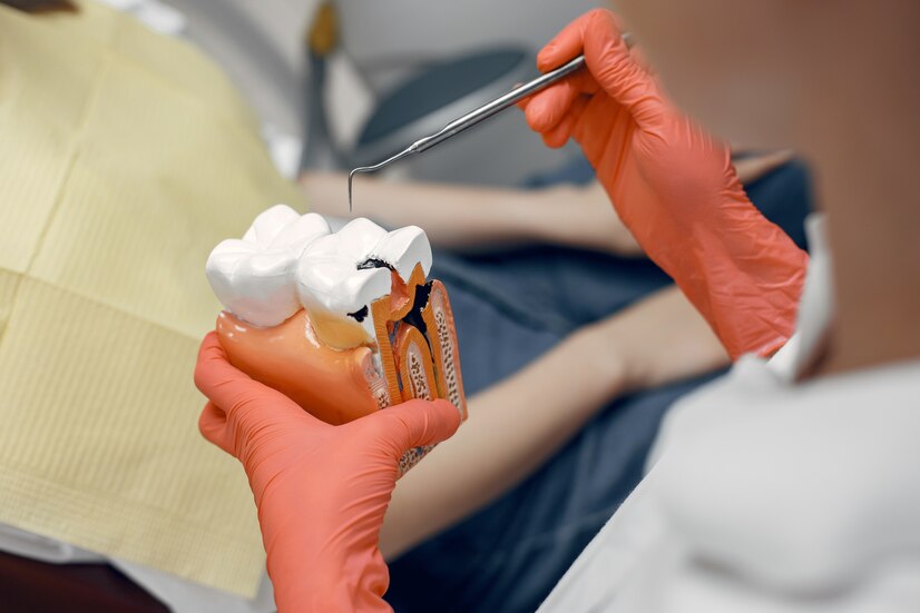  crowns dentist Garden Grove