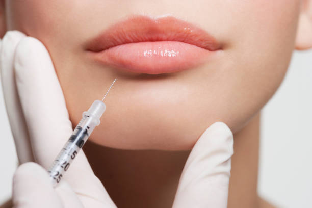 Does Lip Fillers Look Natural