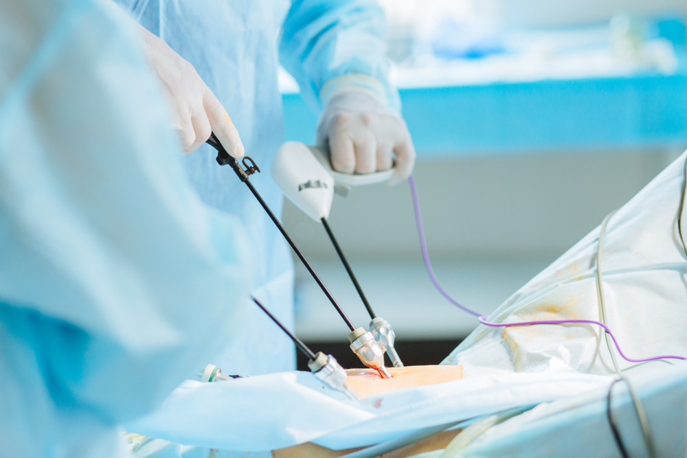 Laparoscopic Surgery in Dubai