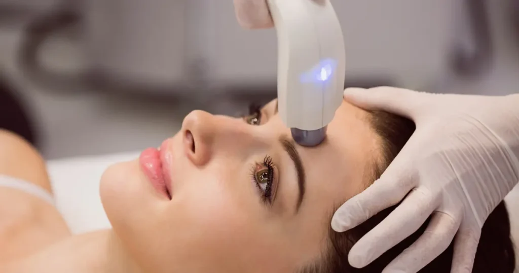 Laser Skin Treatments in Dubai