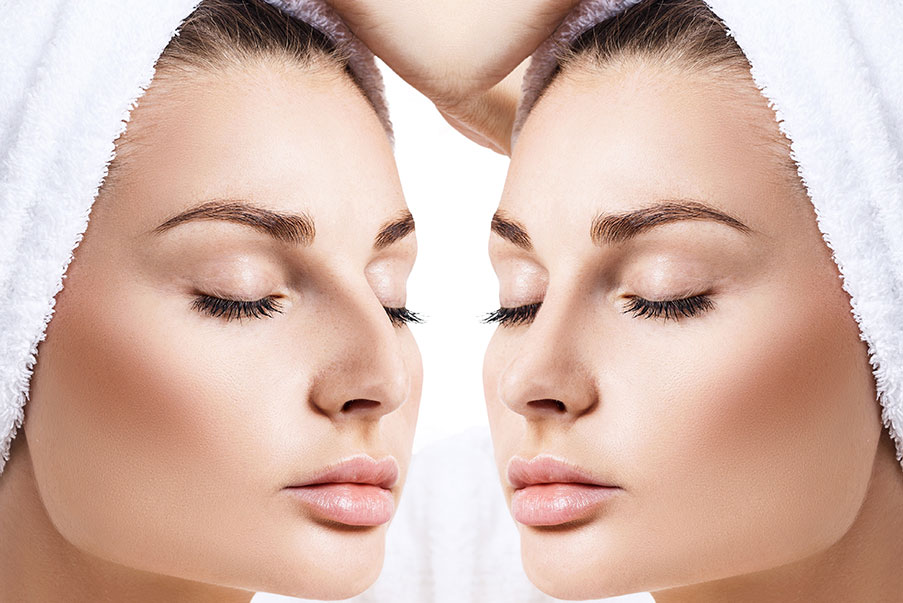 Rhinoplasty in Islamabad