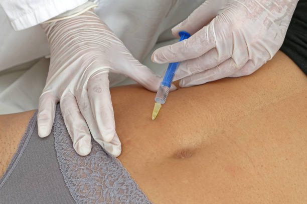 What Areas Suit Aqualyx Injections ?