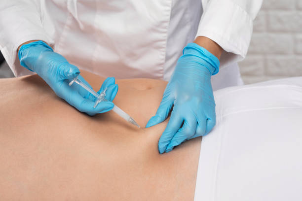 What to Expect from Aqualyx Injection