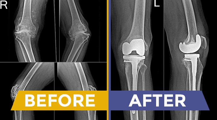 Top Knee Surgeon in Kadapa for Pain-Free Movement and Relief