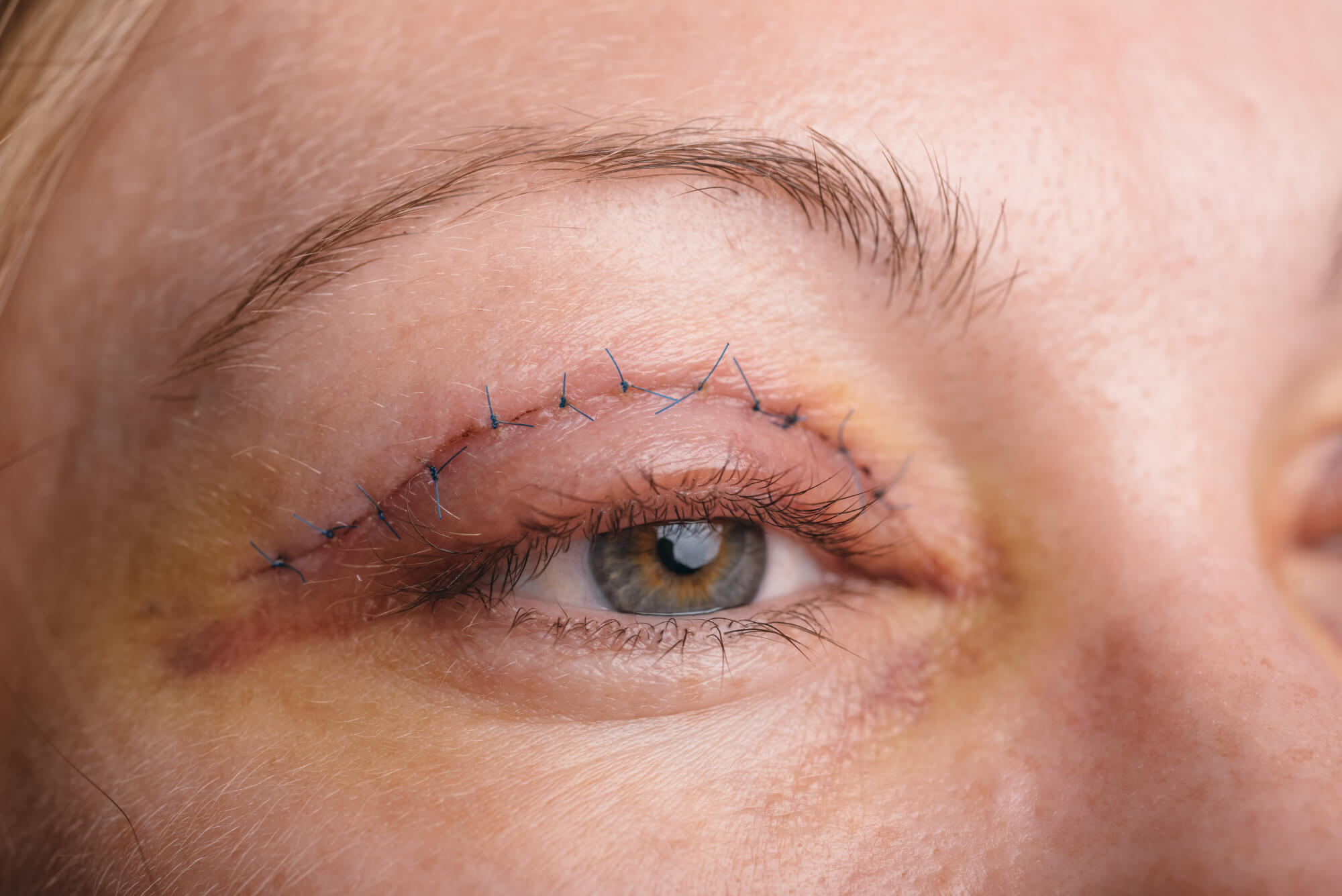 Sharp Eyes, Youthful Appeal – Book Now