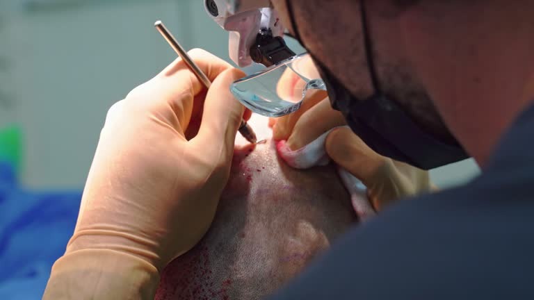 اكتشف قوة زراعة الشعر بتقنية الاقتطاف (FUE)