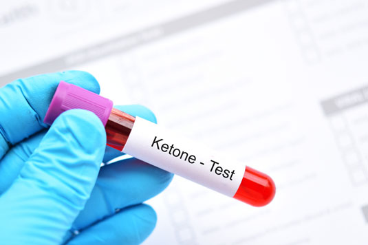 Blood Test at Home for Ketogenic Diet Followers
