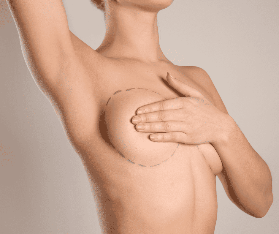 Breast Implant Surgery at Dr. Monisha Kapoor Aesthetics – Safe, Customized Enhancements