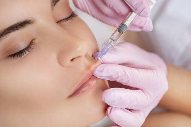 Can Lip Fillers Fix Gummy Smiles or Lip Imbalance
