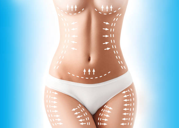 Can Liposuction Help Reduce Fat Pockets Around the Back