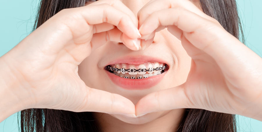 Importance of Regular Dental Checkups with Braces in Islamabad