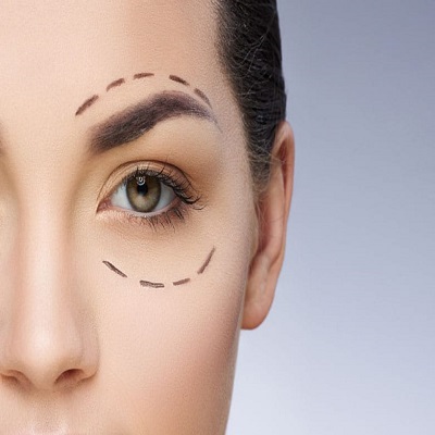 Look Less Tired Instantly with Eyelid Surgery in Islamabad