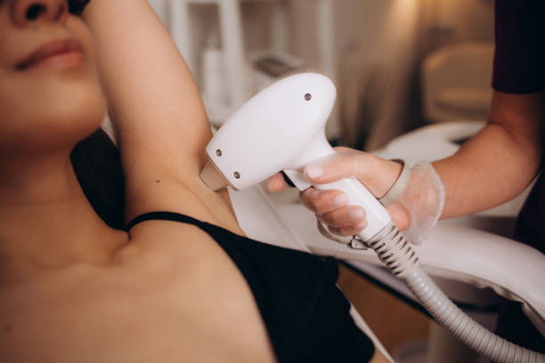 How Effective Is Laser Hair Removal