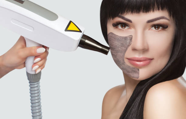 Is Laser Carbon Peel Safe for Sensitive Skin