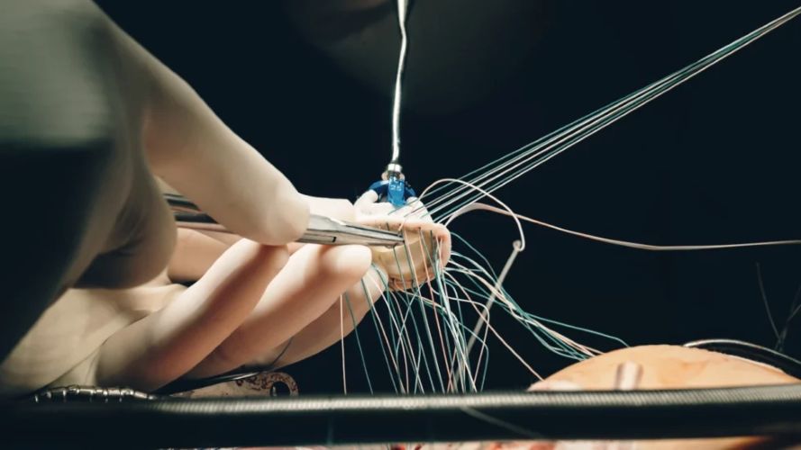 Minimally Invasive Cardiac Surgery,